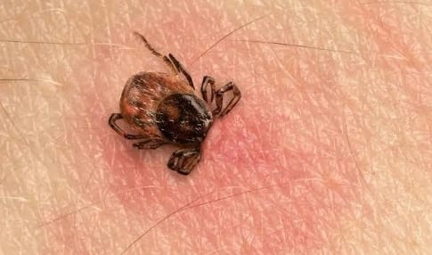 Rickettsia registra 9 muertes en Chihuahua durante 2026; zona Oriente es la más afectada